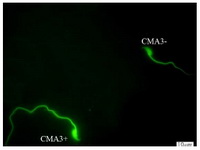 Figure 2. CMA3 staining of spermatozoa; CMA3+ indicates sperm cells with abnormal chromatin and CMA3- indicates sperm cells with normal chromatin (&times;100 eyepiece magnification)