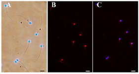 Figure 1. PLC&zeta; immunofluorescence staining. The sperm nuclei are counterstained with DAPI. A: Merged DAPI and bright field images. B: Anti- PLC&zeta; immunofluorescence. C: Merged DAPI and PLC&zeta; stains. Bar=10 &micro;m