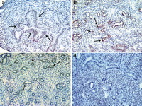 Figure 1. Immunohistochemical detection of IDO-positive cells in the endometrium of pregnant mice at different gestational periods. Uteri of syngeneic pregnant (Balb/c× Balb/c) mice were removed at early (a), mid (b) and late (c) gestational periods and immunostaining for IDO was carried out on the cryosections. In negative control slides (d), primary antibody was pre-adsorbed by an immunizing peptide with a 50-molar concentration. Black arrows show IDO positive cells (Magnification: 200 ×).