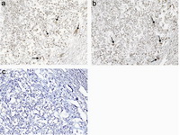 Figure 2. Localization of IDO in placenta of pregnant mice. At mid (a) and late (b) stages of syngeneic mouse pregnancy (Balb/c× Balb/c), placenta was immunostained by IDO-specific antibody. Fig.c: illustrates a representative nega-tive control slide. Black arrows show IDO posi-tive cells (Magnification: 200×).