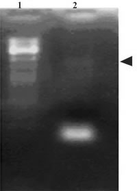 Figure 3. Amplification of PERF15 gene fragment. Samples of 50μl containing standard buffer, 200μM of each dNTP, 40pM of each primer, 100ng genomic DNA, 1.25unit of Taq DNA polymerase to 30 cycles of PCR amplification. Each sample was resolved on a 1% agarose gel containing ethidium bromide. Lane 1(100bp DNA marker), Lane 2 (PCR product).  