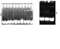 Figure 4. Restriction digest of amplified vector after the sub cloning of 3kb insert. A: Each plasmid was digested with NdeI restriction enzyme (lanes 1-8), undigested recombinant vector (lanes 9& 10), and the very upper band of each lane demonstrates open ring plasmid. B: lanes 1 and 3 show undigested plasmid, lane 2 shows digested recombinant plasmid.