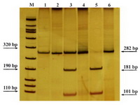 Figure 1. Restriction digestion of PCR products demonstrating the patterns of digestion in different genotypes of VEGF +405 G>C Polymorphism. M: Marker VIII (Roche), 1: Homozygote (variant), 3: Heterozygote (variant and wild type), 5: Homozygote (wild type), 2, 4 and 6: PCR product