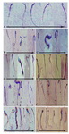 Figure 1. Normal morphological sperm forms in the controls (A) and morphologically abnormal sperms after GnRH-BSA and Kamdhenu ark along with GnRH-BSA administration (B-I) in male Mus musculus.