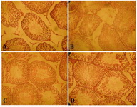 Figure 1. A: Normal Testis with orderly arrangement of ger-minal cells (Hematoxylin and eosin; staining; magnification x100), B: Disordered, sloughed germinal cells within the seminiferous tubules in the torsion/detorsion group (Hema-toxylin and eosin staining; magnification x100), C: Protective effect of rutin 10 mg/kg (Hematoxylin and eosin staining; magnification x100), D: Protective effect of naringin, 
10 mg/kg (Hematoxylin and eosin staining; magnification x10
