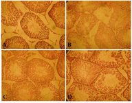 Figure 1. A: Normal Testis with orderly arrangement of ger-minal cells (Hematoxylin and eosin; staining; magnification x100), B: Disordered, sloughed germinal cells within the seminiferous tubules in the torsion/detorsion group (Hema-toxylin and eosin staining; magnification x100), C: Protective effect of rutin 10 mg/kg (Hematoxylin and eosin staining; magnification x100), D: Protective effect of naringin, 
10 mg/kg (Hematoxylin and eosin staining; magnification x10
