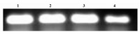 Figure 10. GDNF gene expression in cultured Sertoli cells. 1=Artesunate (5 μM); 2=Artesunate (2.5 μM); 3= Artesu-nate (1.25 μM); 4=Control