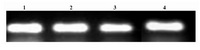 Figure 11. Transferrin gene expression in cultured Sertoli cells. 1=Artesunate (5 μM); 2=Artesunate (2.5 μM); 3= Ar-tesunate (1.25 μM); 4=Control