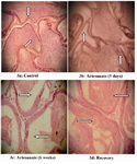 Figure 3. Effects of artesunate administration on the his-tology of rat epididymis. (3a): Control, (3b): Artesunate (5 days), (3c) Artesunate (6 weeks) and (3d) Recovery. (Arrows showing stored sperm cells; Mag. x 100)