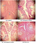 Figure 4. Effects of artesunate administration on the histology of rat testis. (4a): Control, (4b): Artesunate (5 days), (4c): Artesunate (6 weeks) and (4d) Recovery. (Arrows showing somniferous tubules; Mag. x 100)