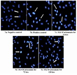 Figure 7. Effects of 10 μM artesunate on ds-DNA integrity of Sertoli cells. (7a) Negative control (untreated) (7b) Positive control (N-9 treated) (7c) 10 μM of artesunate for 24 hours     (7d) 10 μM of artesunate for 72 hours (7e) 10 μM of artesunate for 120 hours. (Arrows showing Sertoli cell nucleus; Mag. x 40)