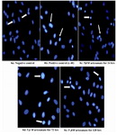 Figure 8. Effects of 5 μM artesunate on ds-DNA integrity of Sertoli cells. (8a) Negative control (untreated) (8b) Positive control (N-9 treated) (8c) 5 μM of artesunate for 24 hours (8d) 5 μM of artesunate for 72 hours (8e) 5 μM of artesunate for 120 hours. (Arrows showing Sertoli cell nucleus; Mag. x 40)