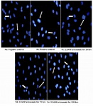 Figure 9. Effects of 2.5 μM artesunate on ds-DNA integrity of Sertoli cells. (9a) Negative control (untreated) (9b) Positive control (N-9 treated) (9c) 2.5 μM of artesunate for 24 hours (9d) 2.5 μM of artesunate for 72 hours (9e) 2.5 μM of artesunate for 120 hours. (Arrows showing Sertoli cell nucleus; Mag. x 40)