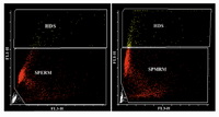 Figure 1. 1a: Cytogram of control semen samples by SCSA. X-axis represents fragmented DNA and Y-axis represents native DNA. 1b: Cytogram of idiopathic RSA semen samples by SCSA. X-axis represents fragmented DNA and Y-axis represents native DNA