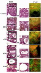 Figure 1. Hematoxylin and Eosin stains and Cx43 immunolocalization for rat ovarian sections of control (A & F), DES (B & G), eCG (C & H), hCG (D & I) and androstenedione (PCO; E & J) treated rats where section in the squares are magnified to reveal the clear structure of the follicle. Image (E) shows a section of polycystic ovary with a follicular cyst (FC) in addition to small follicles (SF). Middle panel represents enlarged areas of similar sizes representing the follicle features in every condition. Cx43 localizes to the GCs in all stained sections. Micrographs are taken at 5X magnification
