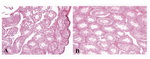 Figure 1. Photomicrographs of mice testis tissue in mice in the treated groups received methylphenidate; A: and the control group; B: (H&E×40)