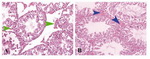 Figure 2. Photomicrographs of mice testis tissue in mice in the treated groups received methylphenidate; A: and the control group; B: Decrease in leydig cells and increase in the space between seminiferous tubules in the treated groups and comparison with the control group (H&E×40)