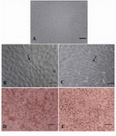 Figure 3. EnSCs differentiate into adipocytes. EnSCs before (A) and after differentiation into adipocytes at 12 days PT (B) and at 21 days PT (C), as demonstrated by light micro-scopy (A,B,C), Oil Red O staining to demonstrate lipid ac-cumulation at 28 days PT (D,E). Arrows in B and C show adipocyte cells (×100 magnification) 