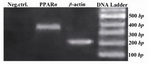 Figure 4. Adipocyte-related gene expression analysis of EnSCs 28 days PT using RT-PCR. β-actin was used as internal standard 