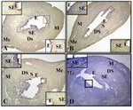 Figure 1. Immunohistochemistry of RHAMM in endome-trium of Estrous groups: Expressions are strong in the epi-thetlial cells (E) of antimesometrial region, as well as sub-epithelial cells (SE) and deep stromal cells (DS) in the pro-estrus group (1a). Moderate RHAMM expressions are seen in the epithelium (E), subepithelium (SE) and deep stroma (DS) in both estrus (1b) and diestrus groups (1c). Negative control without primary antibody (1d). M: Myometrium; Me: Mesometrium. Original magnification 100×, insert 400×