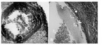 Figure 1. Cross-section of the ovary 63 days after bilateral uterine artery ligation, A: a low magnification view of atretic follicles (301400 µM) with dissociated granulosa cells; B: a high magnification view of atretic follicles (301400 µM) with dissociated GCs; (1) theca externa (2) theca interna (3); note the granulosa cells which are floating in the antrum, toluidine-blue staining, (600×)