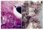 Figure 4. Cross-section from ovary 63 days after bilateral uterine artery liagtion, A) An early atretic follicle; note dense lipidophilic reaction of the oocyte (arrow) and lipid positive ovarian interstitial cells (arrow heads), B) showing intensely lipid positive reacted granulosa cells (arrows). Sudan Black-B staining technique, (A, 400 × and B, 1000 Head ×)