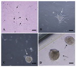 Figure 1. Spermatogonial Stem Cell (SSC) Clusters in vitro culture condition. A: cultured human testicular cells (arrows) before colony formation (7 days after digestion); B: Germ stem cell colonies (arrow) after 2 weeks; C and D: germ stem cell clusters (arrows) after 4 and 8 weeks of culture after being transferred into laminin. Scale bar 50 m