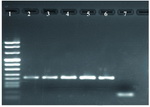 Figure 1. Detection of C. trachomatis from cervical swab specimens by PCR using orf8 primers. Lane 1, DNA size markers; Lane 2-5, positive patients for C. trachomatis; Lane 6, positive control; Lane 7, negative control