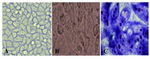 Figure 2. MacCoy cell line; A: before inoculation of specimen; B: after inoculation and C: after Gimsa staining 