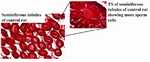 Figure 1. Transverse sections (TS) of the seminiferous tubules of control rats