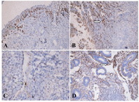 Figure 1. Immunostaining of apelin in eutopic and ectopic endometria. In eutopic and ectopic endometrial glands, apelin was expressed diffusely in the secretory phase and downregulated in the proliferative phase. Stromal staining intensity of apelin was very low in both the eutopic and ectopic endometria (×200). A: Eutopic proliferative endometrium; B: Eutopic secretory endometrium; C: Ectopic proliferative endometrium; D: Ectopic secretory endometrium