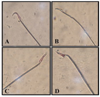 Figure 1. Representative photomicrographs of sperm. A: Normal sperm, B: sperm without hook, C: banana head sperm, D: sperm with triangular heads 