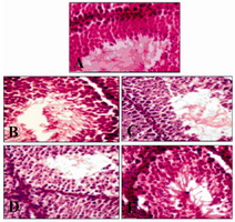 Figure 2. Photomicrographs of stained histological slides of the testis after 45 days of treatment; A: Group I (Control),  B: Group II (AMP 20 mg/kg), C: Group III (SASP 200 mg/kg), D: Group IV (Combination), E: Group V (Recovery)
