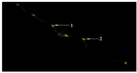 Figure 3. MTX+EP group: sperm with normal DNA integrity had green fluorescence, and those with diminished DNA integrity had orange-red staining (Acridine orange ×400)