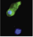 Figure 1. Cumulus cells positive (top) or negative (bottom) for Annexin V staining. DNA is stained with Hoescht 33342
