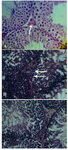 Figure 1. Seminiferous tubule epithelium stained with H&E and its morphology evaluated with light microscope. A: Seminiferous tubules in control group. Leydig cell illustrated with the arrow. In the control group, the seminiferous tubules cells were arranged normally without any increase in basement membrane thickness, B: HFD+Antioxidants group and sper-matogonia pointed with the arrow, C: Seminiferous tubules in HFD group. Basement membrane thickness and number of spermatocyte I increased in this group