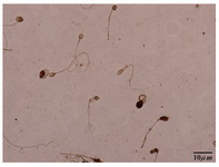 Figure 2. TUNEL staining: brown stained sperm shows apoptosis+, light colored sperm indicates apoptosis -