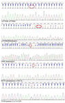 Figure 1. Nucleotide alterations identified by sequencing