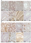 Figure 3. Immunohistochemical staining of FGFR1; A: and FGFR2 B: during postnatal testicular development. Prominent im-munostaining of FGFR1 and FGFR2 are observed in interstitial (red arrows) and peritubular cells with no significant changes among all age groups. In the seminiferous tubular compartment, spermatogonia, spermatocytes, round spermatids and Sertoli cells (black arrows) exhibit weak immunostaining for these FGFRs in all age groups. The immunostaining for these FGFRs was also evident in elo/ngated spermatid, spermatozoa and sperm in the epididymis. In adult testes, the weakest immunostaining for FGFR1 and FGFR2 were found in stages IX and X of the seminiferous epithelial cycle, and other stages displayed no significant changes. The primary antibodies replaced by irrelevant rabbit IgG served as a procedural control. A 60-day old control picture is presented. The control pictures for other age groups are not shown