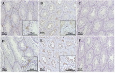 Figure 6. Immunohistochemistry reveals the absence of FGFR1 (A) and FGFR2 (D) in spermatogonia, spermatocytes and spermatids of Tex101-iCre;Fgfr1flox/flox (A) and Tex101-iCre;Fgfr2flox/flox (D) adult mice, while immunostaining of FGFR1 (A) and FGFR2 (D) in interstitial and peritubular cells was comparable to wild-type animals (B & E). Omission of the FGFR1 (C) and FGFR2 (F) primary antibodies served as a procedural control.