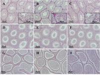 Figure 7. Morphological analyses of H & E stained sections of the testes; A-C: and caput D-F: and cauda G-I: epididymis do not show any abnormalities in either Tex101-iCre;Fgfr1flox/flox (A, D & G) or Tex101-iCre;Fgfr2flox/flox (B, E & H) adult mice as compared to wild-type siblings (C, F & I)