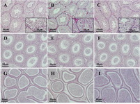 Figure 7. Morphological analyses of H & E stained sections of the testes; A-C: and caput D-F: and cauda G-I: epididymis do not show any abnormalities in either Tex101-iCre;Fgfr1flox/flox (A, D & G) or Tex101-iCre;Fgfr2flox/flox (B, E & H) adult mice as compared to wild-type siblings (C, F & I)