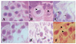 Figure 1. Morphological changes in the testis of different groups. Ethanol consumption induced an increase in glygo-gen droplet and vacuolization of testis tissue. Vitamin E treatment along ethanol consumption alleviated the structure changes. A: control 21 day, H&E staining; B: ethanol PN 21 H&E staining; C: ethanol PN 21 PAS staining; D: ethanol-vitamin E PN 21 H&E staining; E: ethanol PN 90 PAS staining; F: ethanol PN 90 H&E staining (>) cell vacuolization, (->) glycogen droplet (Magnification ×400)