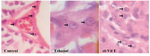 Figure 2. Photomicrograph showing the density of Leydig cells in different groups (>) Leydig cells (Magnification ×400)