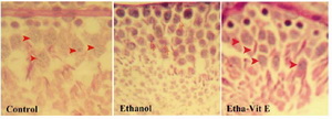Figure 3. Histophatology of testis tissue in control, ethanol rats, and ethanol-vitamin E rats (hematoxylin-eosin, original magnification×400). (Control) Control testis tissue with normal genocytes location undergoing mitosis division. (Ethanol)  ethanol testis tissue showed that primordial germ cells were located close to membrane with more chromatin clumping in genocytes which indicates less activation and preparation of genocytes for the mitosis process. (etha-Vit E) the morphology of the ethanol-vitamin E-treated group was similar to that of the control group (->) normal cell activation and division, (>) more chromatin clumping in genocytes
