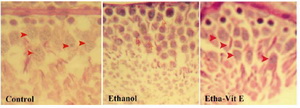 Figure 3. Histophatology of testis tissue in control, ethanol rats, and ethanol-vitamin E rats (hematoxylin-eosin, original magnification×400). (Control) Control testis tissue with normal genocytes location undergoing mitosis division. (Ethanol)  ethanol testis tissue showed that primordial germ cells were located close to membrane with more chromatin clumping in genocytes which indicates less activation and preparation of genocytes for the mitosis process. (etha-Vit E) the morphology of the ethanol-vitamin E-treated group was similar to that of the control group (->) normal cell activation and division, (>) more chromatin clumping in genocytes
