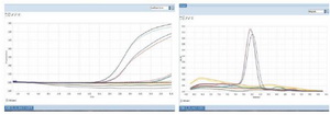 Figure 2. Real time PCR shows both amplification curve and Melt peak. No amplification of AZFa, AZFb and AZFc in test sample, but SRY and ZFX, the internal control genes show amplification