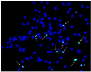 Figure 3. TUNEL Assay picture. Sperms with DNA damaged (green) were shown with arrows and Sperms without DNA damage were in blue color