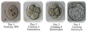 Figure 1. The development of 3PN embryos