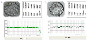 Figure 2. NGS profile of 3PN embryos